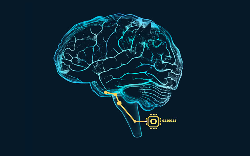 Neurovalens